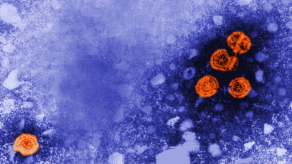 STAT+: GSK picks up hep B drug approval